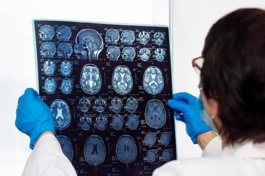 Encefalopatia u dzieci: Kluczowe informacje o definicji, objawach i diagnostyce